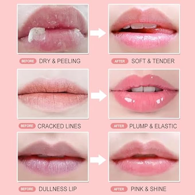 SWIUKPHE 3 PCS WATERMELON LIP BALM, HONEY POT LIP BALM,STRAWBERRY LIP MASK OVERNIGHT HYDRATING DRY AND CRACK LIP SCRUBS EXFOLIATOR PROPOLIS LIP SLEEPING MASK (STRAWBERRY & WATERMELON & HONEY) - Image 3